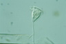 Vorticella