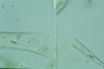 Vorticella