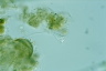 Vorticella