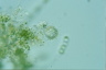 Choanocystis