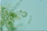 Choanocystis