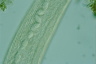 Spirostomum ambiguum