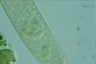 Spirostomum ambiguum