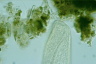 Spirostomum ambiguum