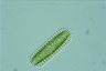 Surirella