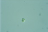 Oocystis marssonii