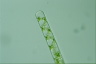 Spirogyra