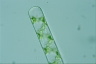 Spirogyra