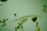 Spirostomum teres