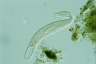 Spirostomum teres