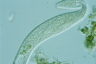 Spirostomum teres