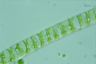 Spirogyra