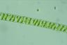 Spirogyra