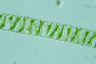 Spirogyra