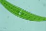 Closterium moniliferum