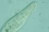 Paramecium caudatum