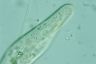 Paramecium caudatum