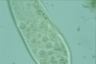 Paramecium caudatum