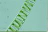 Spirogyra