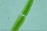 Closterium ralfsii