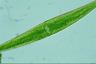 Closterium ralfsii