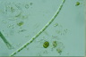 Microspora