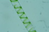 Spirogyra