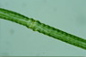 Pleurotaenium