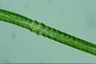 Pleurotaenium