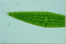 Closterium lunula