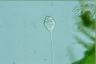 Vorticella