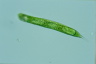 Euglena oxyuris