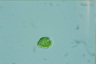 Gonyostomum depressa