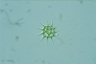 Pediastrum simplex