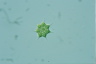 Pediastrum simplex