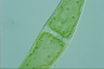 Closterium ehrenbergii