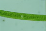 Closterium turgidum