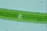 Closterium turgidum