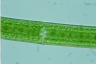 Closterium turgidum