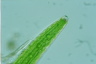 Closterium turgidum