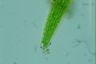 Closterium turgidum