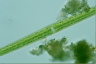 Closterium praelongum