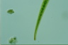 Closterium ralfsii