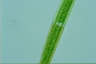 Closterium ralfsii