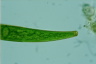 Closterium striolatum