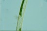 Closterium angustatum