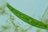 Closterium striolatum