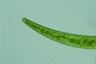 Closterium striolatum