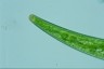 Closterium striolatum