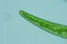 Closterium striolatum